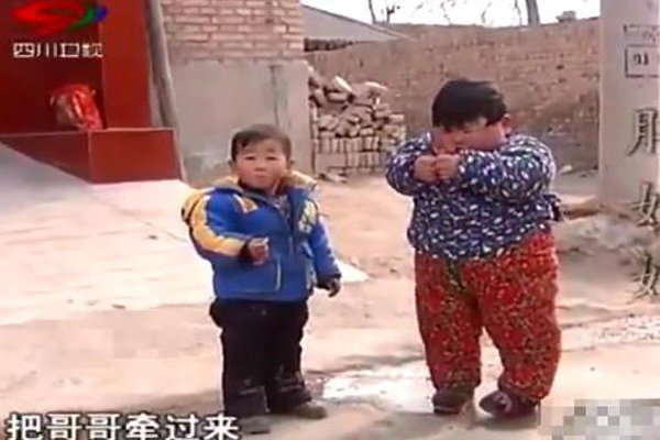 Mẹ chiều chuộng cho ăn uống thoải mái, bé 2 tuổi có cân nặng amp;#34;khủngamp;#34; gần 40kg, chân biến dạng - 3
