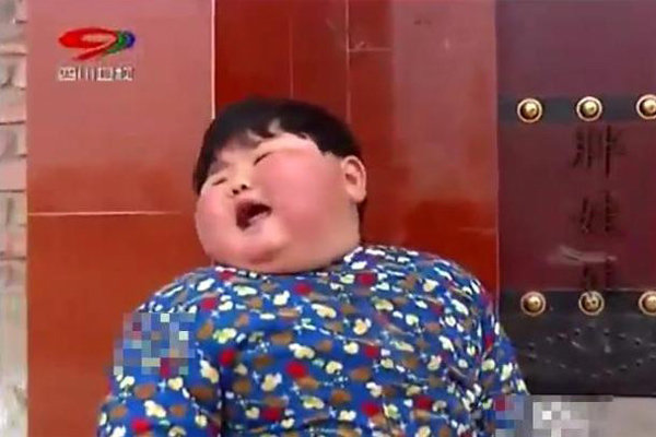 Mẹ chiều chuộng cho ăn uống thoải mái, bé 2 tuổi có cân nặng amp;#34;khủngamp;#34; gần 40kg, chân biến dạng - 2