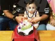 Tin tức - Bé trai 1 tuổi bị nhiễm trùng phổi nặng, nghi hít phải khói thuốc trong nhà hàng