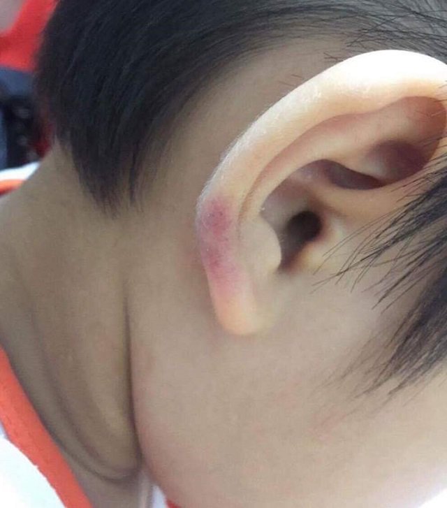 Phẫn nộ trước cảnh cô giáo mầm non hành hạ con riêng của chồng ở Hà Nội - 1