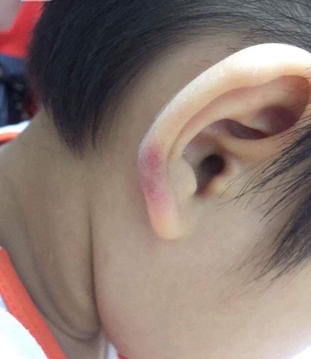 Tin tức nổi bật trong tuần: Cô giáo mầm non ở Hà Nội đánh con riêng của chồng thậm tệ - 1