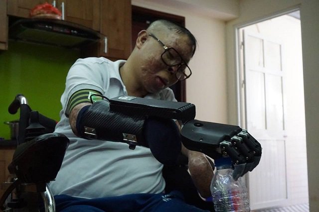 Cuộc sống mới của chiến sĩ sống sót trong vụ trực thăng rơi ở HN khi có bàn tay giả - 2