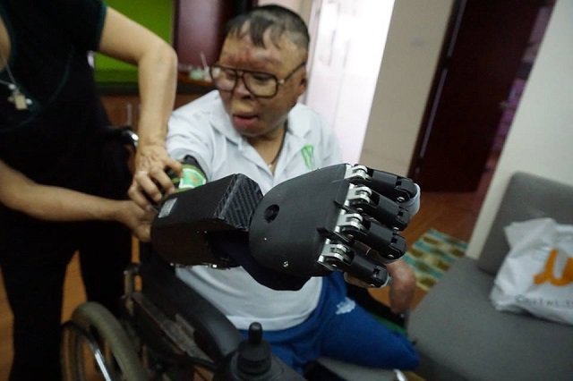 Cuộc sống mới của chiến sĩ sống sót trong vụ trực thăng rơi ở HN khi có bàn tay giả - 6