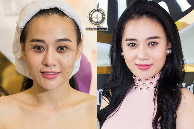 Đừng để da mình “xuống cấp không phanh” vì tiếc tiền đi thẩm mỹ! - 1