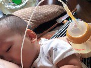 Làm mẹ - Con không chịu bú bình, mẹ cắt ống truyền làm "cần câu" giúp bé ti ầm ầm hết bay 180ml