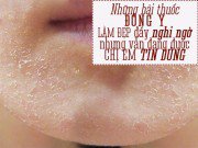 Làm đẹp - Các nàng hãy nhớ: Thuốc đông y không rõ nguồn gốc nguy hiểm cho da ngang kem trộn!