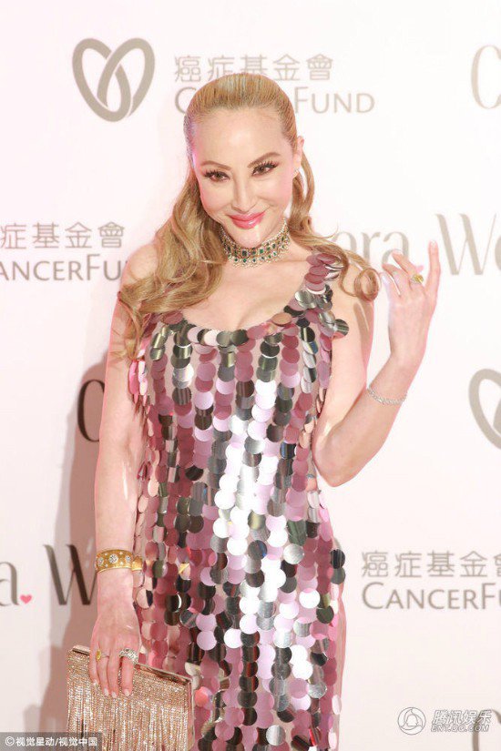 amp;#34;Thảm họa thẩm mỹamp;#34; Hong Kong gây bất ngờ vì mắc ung thư vú vẫn tiếp tục amp;#34;dao kéoamp;#34; - 3