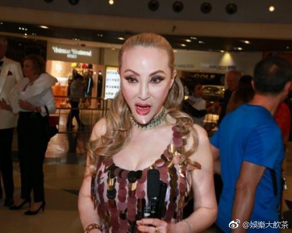 amp;#34;Thảm họa thẩm mỹamp;#34; Hong Kong gây bất ngờ vì mắc ung thư vú vẫn tiếp tục amp;#34;dao kéoamp;#34; - 4