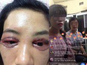 Làm đẹp - Đây là vụ cắt mí hỏng nát bét cho khách xôn xao dư luận nhất những ngày qua