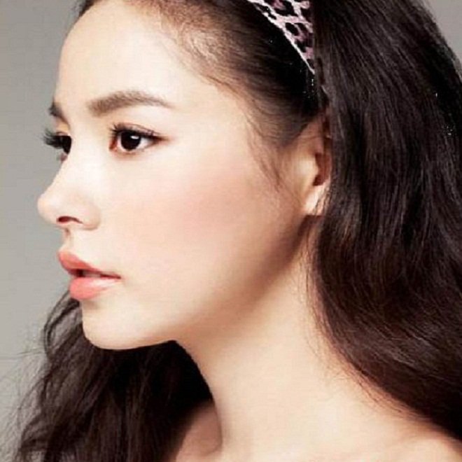 Hãy tỉnh táo và thông minh trước lời mời amp;#34;nâng mũi giá rẻamp;#34; tưởng là hấp dẫn! - 1
