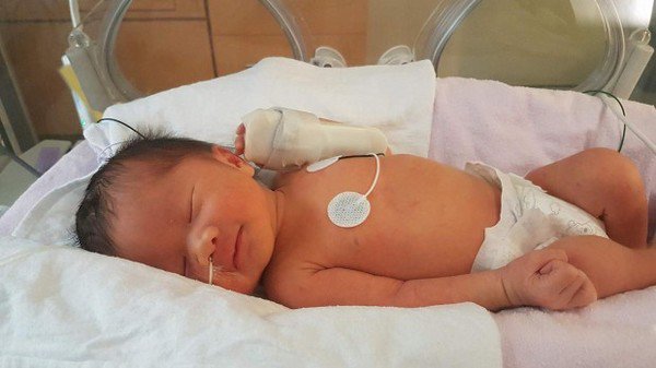 Đây là bệnh nhân nhỏ tuổi nhất thế giới, được bác sĩ phẫu thuật từ trong bụng mẹ - 4