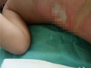 Tin tức - Bé gái 3 tuổi bị bỏng nặng vì xô nước nóng của cô giáo mầm non