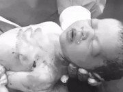 Bà bầu - Khoảnh khắc siêu đáng yêu của em bé vừa chui ra khỏi bụng mẹ vừa hắt hơi