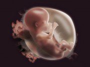 Chuẩn bị mang thai - Mang thai lần đầu đa ối, thai dị tật, lần sau có nguy cơ lặp lại không?