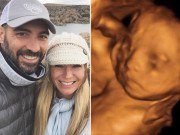 Bà bầu - Tưởng được hạnh phúc sau 4 lần sảy thai, mẹ bầu lại nhận tin sét đánh ở tuần thứ 18