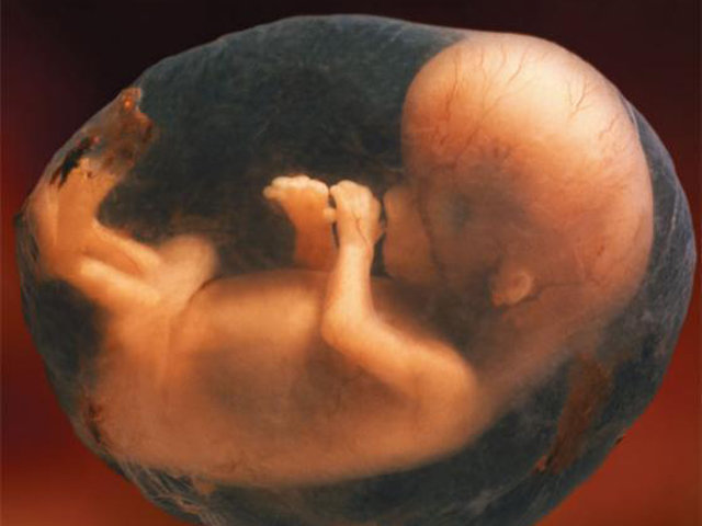 Mẹ bầu hay làm 4 việc này rất dễ khiến em bé trong bụng bị suy dinh dưỡng bào thai