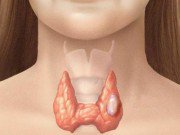 Sức khỏe - Sau ung thư vú, bệnh ung thư nào đe doạ chị em phụ nữ ?