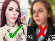 Làm đẹp - Hotgirl chuyển giới 1 triệu followers bất ngờ chia sẻ ảnh mặt biến chứng sau khi nạo silicon