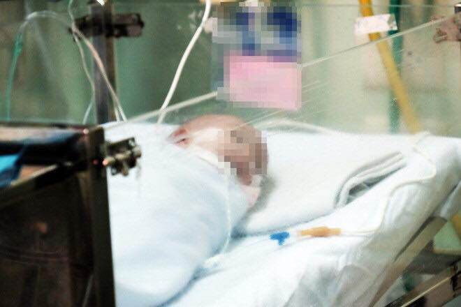 Bé gái sinh non ở tuần 24 thai kỳ,  chỉ nặng 660 gram thoát khỏi lưỡi hái “tử thần” - 1