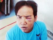 Tin tức - Từ vụ bảo vệ sát hại bé 6 tuổi: Nhận biết bệnh nhân tâm thần qua bài test cơ bản