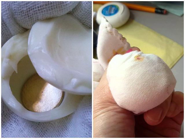 Dùng lòng trắng trứng, dây bạc hạ sốt cho trẻ, mẹ bỉm sữa bảo hiệu quả, bác sĩ nói gì? - 2