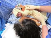 Bà bầu - Khoe ảnh vết mổ sau sinh, bà mẹ trầm cảm vì nhận chỉ trích "đẻ mổ là sợ khổ"