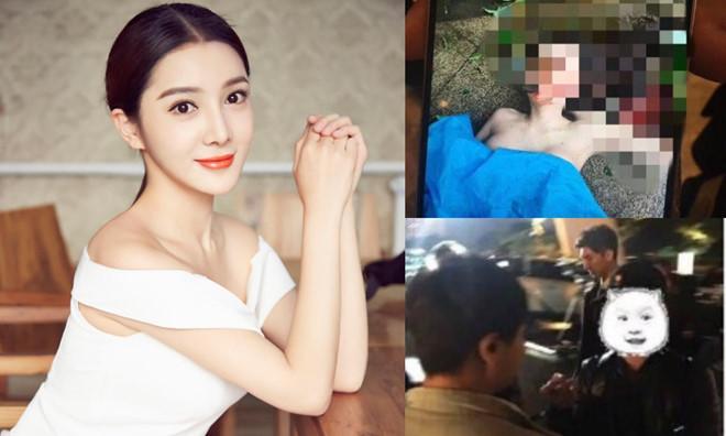 Xác nhận thông tin amp;#34;tiểu Angelababyamp;#34; ở trong khách sạn với người tình trong đêm amp;#34;trượt chân ngãamp;#34; - 1