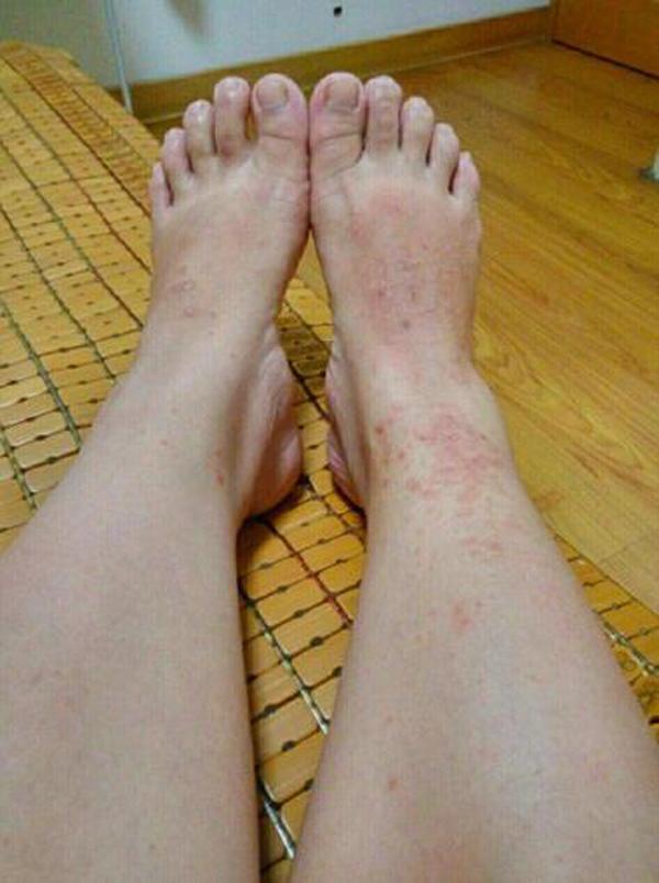 Bị ngứa nhưng b&aacute;c sĩ cho thuốc kh&ocirc;ng uống, b&agrave; mẹ hốt hoảng khi sinh ra con  da xanh