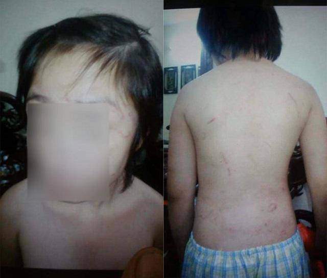 Con trai mắc lỗi, ông bố không cầm roi đánh con mà... tự tay đánh mình - 1
