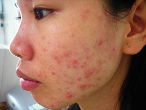 tat tan tat cong dung lam dep cua dau dua va tac hai khon luong neu dung sai cach - 11