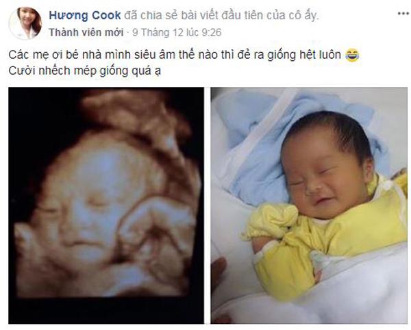 Mẹ Việt thích thú chia sẻ ảnh bé chào đời chẳng khác gì khi siêu âm cực đáng yêu - 1