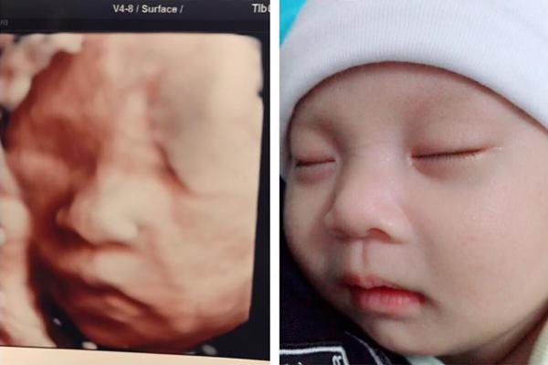 Mẹ Việt thích thú chia sẻ ảnh bé chào đời chẳng khác gì khi siêu âm cực đáng yêu - 3