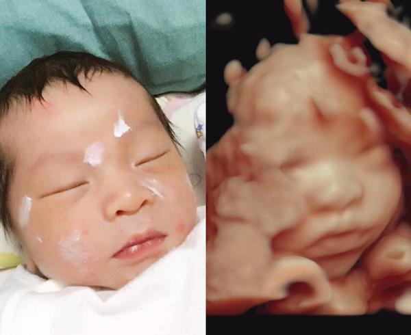 Mẹ Việt thích thú chia sẻ ảnh bé chào đời chẳng khác gì khi siêu âm cực đáng yêu - 4