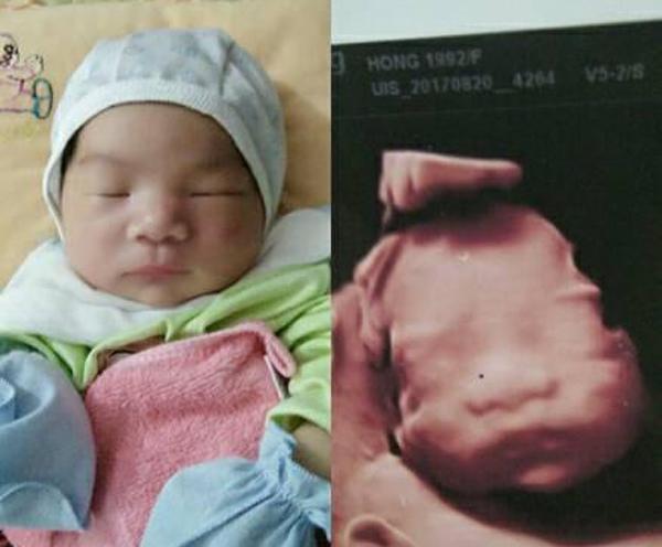 Mẹ Việt thích thú chia sẻ ảnh bé chào đời chẳng khác gì khi siêu âm cực đáng yêu - 6