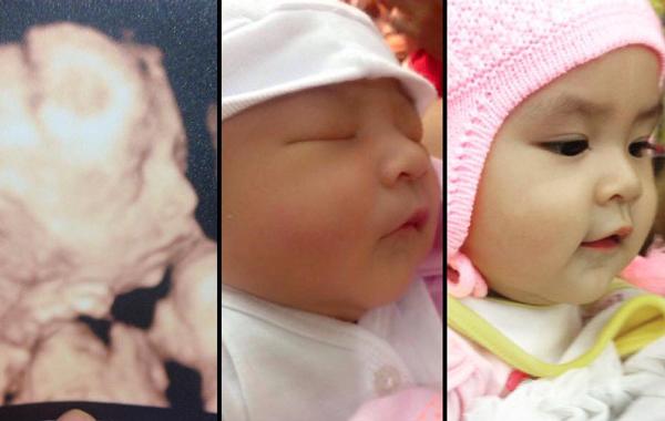 Mẹ Việt thích thú chia sẻ ảnh bé chào đời chẳng khác gì khi siêu âm cực đáng yêu - 7