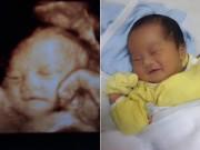Bà bầu - Mẹ Việt thích thú chia sẻ ảnh bé chào đời chẳng khác gì khi siêu âm cực đáng yêu