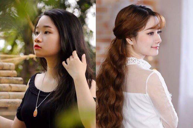 Nhật kí cắt mí mắt của cô nàng 9x từng lo sợ mắt sẽ bị amp;#34;trợnamp;#34; sau phẫu thuật! - 3