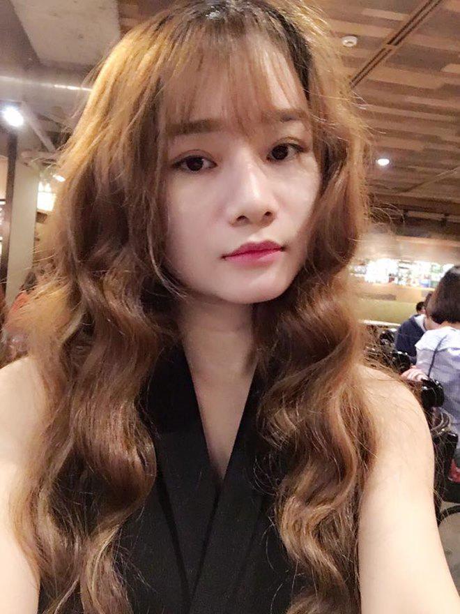 Nhật kí cắt mí mắt của cô nàng 9x từng lo sợ mắt sẽ bị amp;#34;trợnamp;#34; sau phẫu thuật! - 7