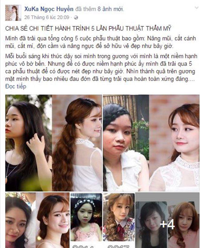 Nhật kí cắt mí mắt của cô nàng 9x từng lo sợ mắt sẽ bị amp;#34;trợnamp;#34; sau phẫu thuật! - 2
