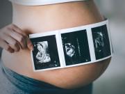 Bà bầu - Tự tin đi kiểm tra thai, mẹ choáng váng nghe bác sĩ nói tính mạng đang nguy hiểm