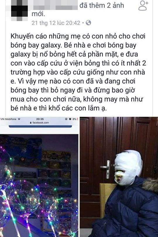 Mẹ phải biết bóng bay galaxy siêu hot rất nhiều trẻ đòi mua có thể khiến bé bỏng cả mặt - 1