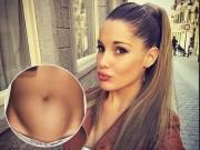 Bà bầu - Bà mẹ khoe bụng bầu trái tim được triệu người thích, không ngờ là do tử cung bất thường