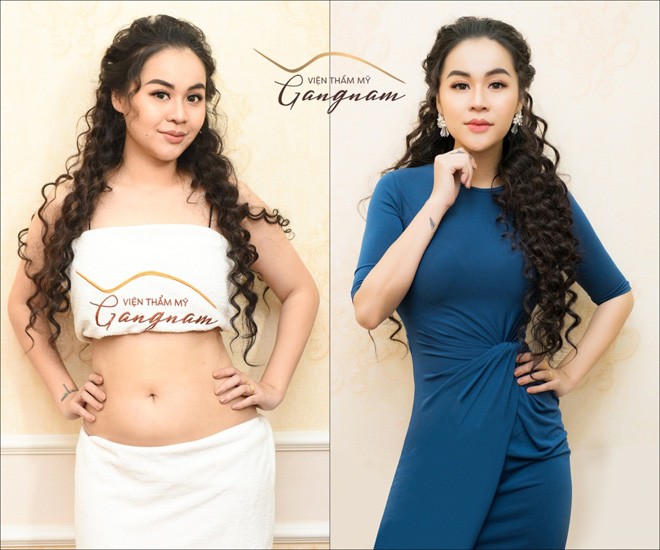 amp;#34;Bãoamp;#34; ưu đãi cho siêu phẩm giảm béo từ thẩm mỹ viện của đại gia Hàn Quốc - 3