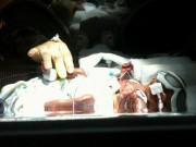 Bà bầu - Nghẹn lòng tâm sự của bà mẹ nuôi 3 con sinh non trong phòng chăm sóc đặc biệt