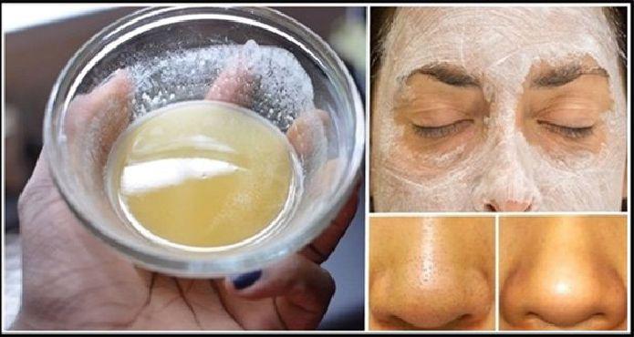 Chiêu hay trị mụn thâm siêu tốc bằng baking soda giúp chị em tỏa sáng mùa Tết! - 7