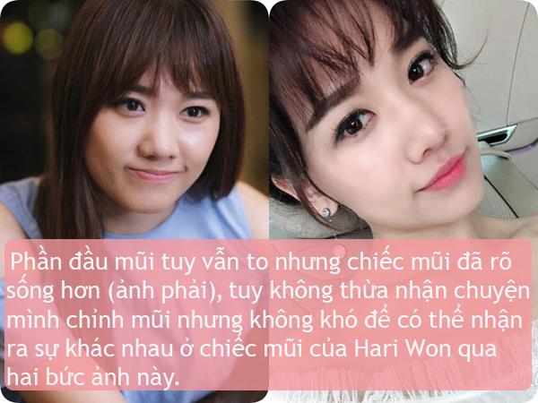 Ít ai biết điểm chung nhan sắc của vợ 3 danh hài hot nhất showbiz Việt - 5
