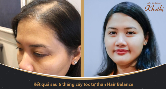 Giải pháp “cấp cứu” hiệu quả cho mái tóc thưa, mỏng của chị em - 4