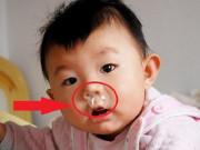 Bé ho đờm, viêm hô hấp dai dẳng mấy, uống thứ này 1 tuần khỏe ngay!