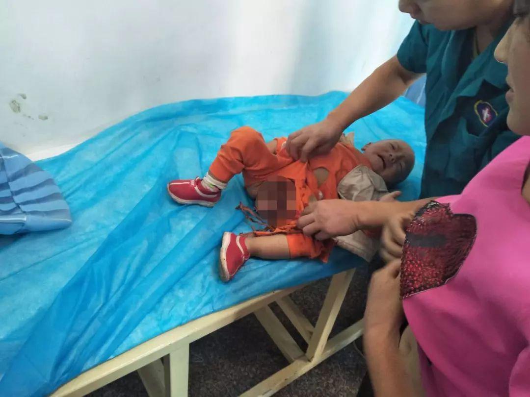 Bé trai 2 tuổi bị kẹt dương vật ở thang cuốn, ai nhìn hình ảnh cũng xót - 4