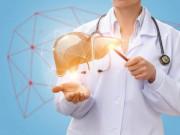 Sức khỏe - Bệnh viêm gan A là gì? Lây qua những đường nào?